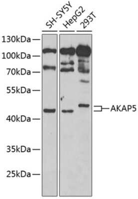 Western Blot: AKAP5 AntibodyBSA Free [NBP2-92794]