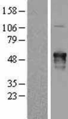 Western Blot: AKAP5 Overexpression Lysate [NBL1-07429]