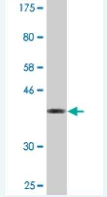 Western Blot: AKAP6 Antibody (2E8) [H00009472-M07]