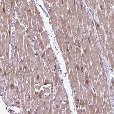 Immunohistochemistry-Paraffin: AKAP6 Antibody [NBP2-38590]