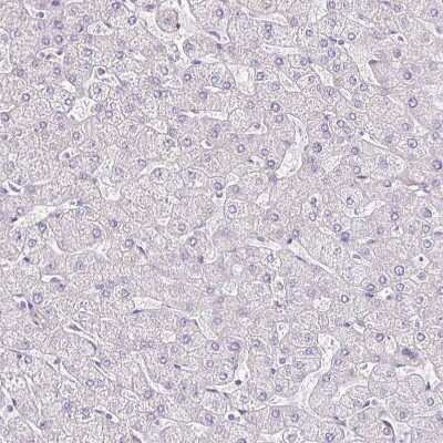 Immunohistochemistry-Paraffin: AKAP6 Antibody [NBP2-38590]