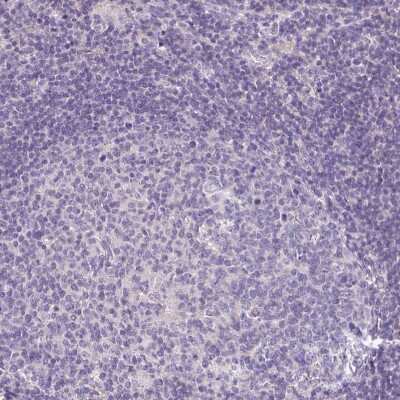 Immunohistochemistry-Paraffin: AKAP6 Antibody [NBP2-38590]