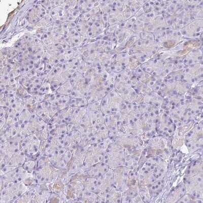 Immunohistochemistry-Paraffin: AKAP6 Antibody [NBP2-38590]