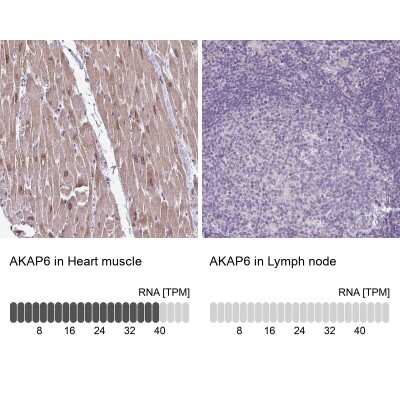 Immunohistochemistry-Paraffin: AKAP6 Antibody [NBP2-38590]