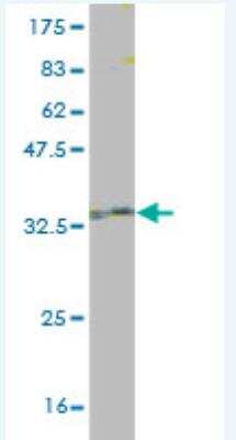 Western Blot: AKAP7 Antibody (2B3) [H00009465-M01]