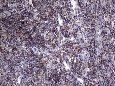 Immunohistochemistry: AKAP7 Antibody (OTI6F7) [NBP2-46504]