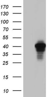 Western Blot: AKAP7 Antibody (OTI6F7) [NBP2-46504]