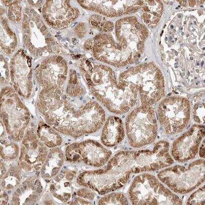 Immunohistochemistry: AKAP7 Antibody [NBP1-89170]