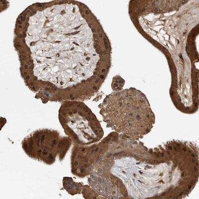Immunohistochemistry: AKAP7 Antibody [NBP1-89171]