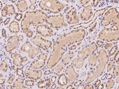 Immunohistochemistry-Paraffin: AKAP7 Antibody [NBP2-97418]