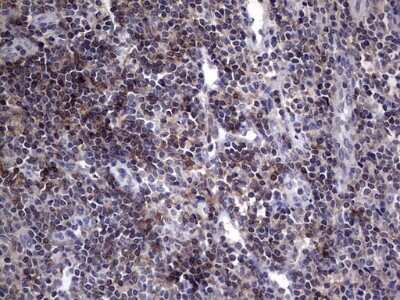 Immunohistochemistry: AKAP7 Antibody (OTI6F7) - Azide and BSA Free [NBP2-71466]