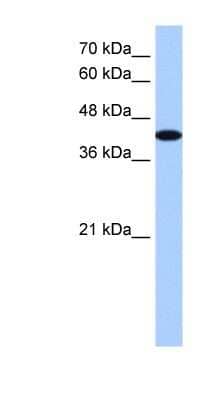 Western Blot: AKAP7 Antibody [NBP1-53116]