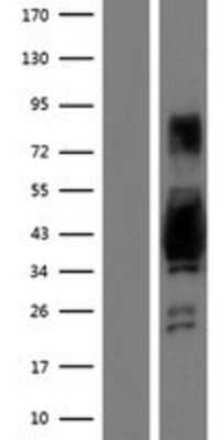 Western Blot: AKAP7 Overexpression Lysate [NBP2-07037]