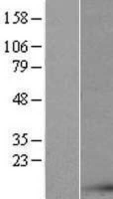 Western Blot: AKAP7 Overexpression Lysate [NBP2-07815]