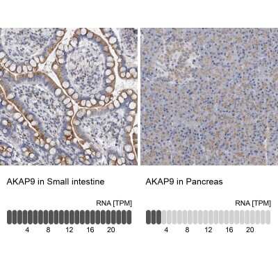 Immunohistochemistry-Paraffin: AKAP9 Antibody [NBP1-89166]