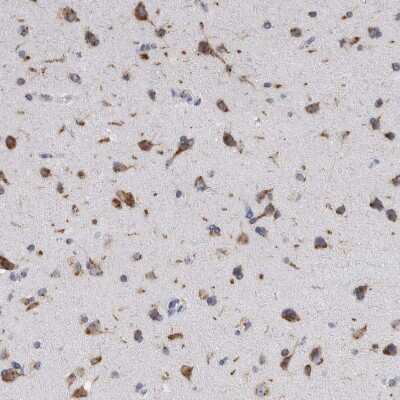 Immunohistochemistry-Paraffin: AKAP9 Antibody [NBP1-89166]
