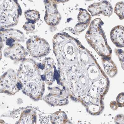 Immunohistochemistry-Paraffin: AKAP9 Antibody [NBP1-89166]