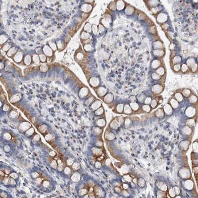 Immunohistochemistry-Paraffin: AKAP9 Antibody [NBP1-89166]