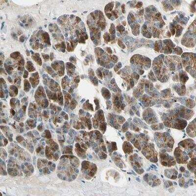 Immunohistochemistry-Paraffin: AKAP9 Antibody [NBP1-89167]