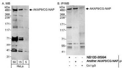 Western Blot: AKAP9 Antibody [NB100-86994]