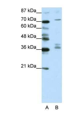 Western Blot: AKAP9 Antibody [NBP1-80308]