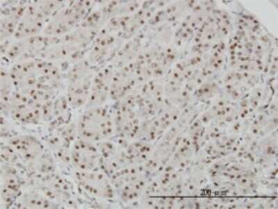 Immunohistochemistry-Paraffin: AKAP95/AKAP8 Antibody (3D4) [H00010270-M01]