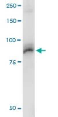 Immunoprecipitation: AKAP95/AKAP8 Antibody (3D4) [H00010270-M01]