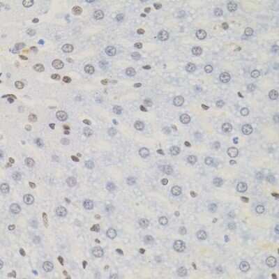 Immunohistochemistry-Paraffin: AKAP95/AKAP8 Antibody - BSA Free [NBP3-03023]