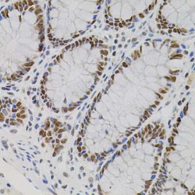 Immunohistochemistry-Paraffin: AKAP95/AKAP8 Antibody - BSA Free [NBP3-03023]