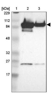 Western Blot: AKAP95/AKAP8 Antibody [NBP1-90196]