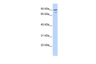 Western Blot: AKAP95/AKAP8 Antibody [NBP2-86970]