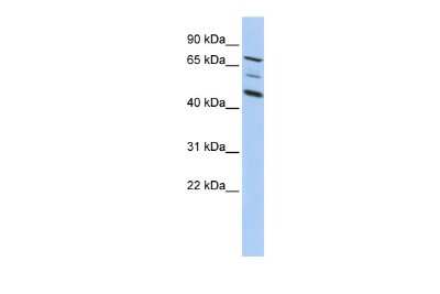 Western Blot: AKAP95/AKAP8 Antibody [NBP2-86971]