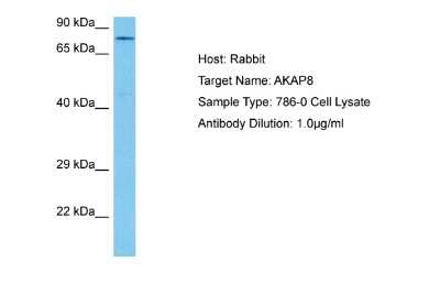 Western Blot: AKAP95/AKAP8 Antibody [NBP2-86972]