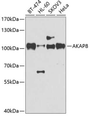 Western Blot: AKAP95/AKAP8 AntibodyBSA Free [NBP3-03023]