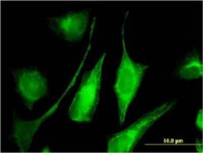 Immunocytochemistry/ Immunofluorescence: AKD1 Antibody (1H8) [H00221264-M01]