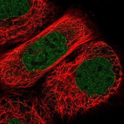 Immunocytochemistry/ Immunofluorescence: AKD1 Antibody [NBP2-33937]