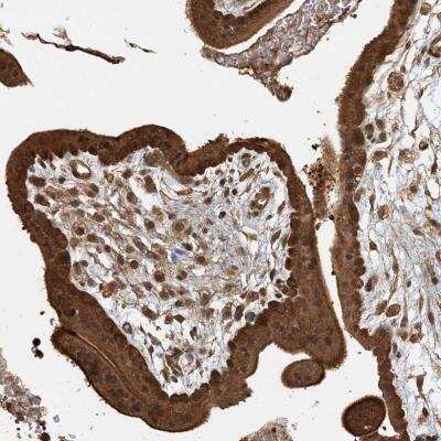 Immunohistochemistry-Paraffin: AKD1 Antibody [NBP2-33960]