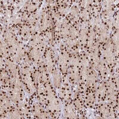 Immunohistochemistry: AKD1 Antibody [NBP2-34029]