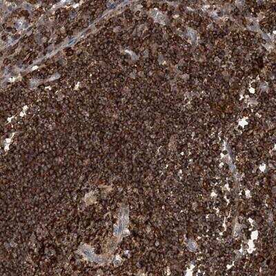 Immunohistochemistry-Paraffin: AKD1 Antibody [NBP1-89162]