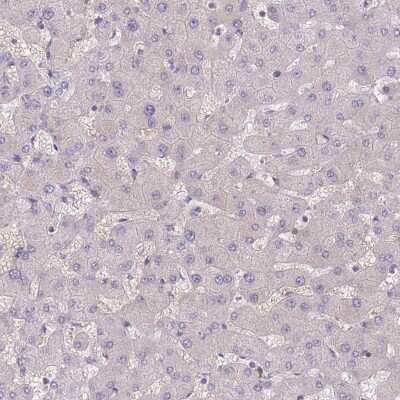 Immunohistochemistry-Paraffin: AKD1 Antibody [NBP2-34033]