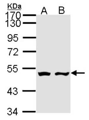 Western Blot: AKD1 Antibody [NBP1-31145]