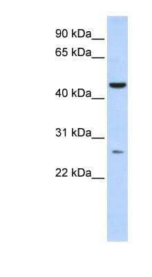 Western Blot: AKD1 Antibody [NBP1-56395]