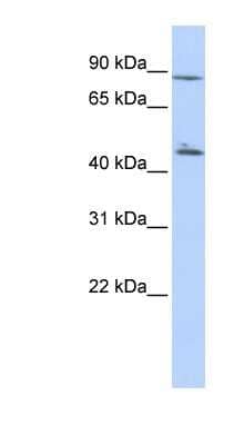 Western Blot: AKD1 Antibody [NBP1-56791]