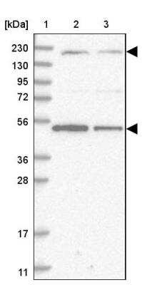 Western Blot: AKD1 Antibody [NBP2-33936]