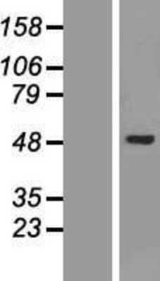 Western Blot: AKD1 Overexpression Lysate [NBL1-08523]