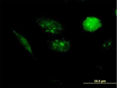 Immunocytochemistry/ Immunofluorescence: AKIP Antibody [H00054998-B01P]