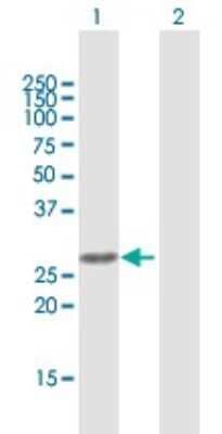 Western Blot: AKIP Antibody [H00054998-B01P]