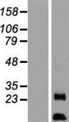 Western Blot: AKIP Overexpression Lysate [NBL1-07859]