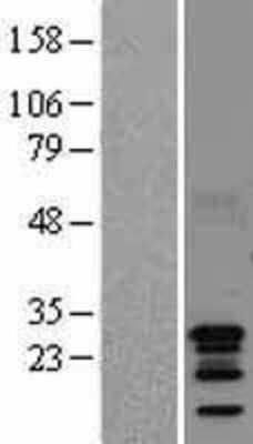 Western Blot: BCA3 Overexpression Lysate [NBL1-08095]