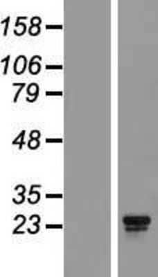 Western Blot: BCA3 Overexpression Lysate [NBL1-08096]